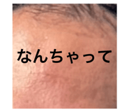 846199141