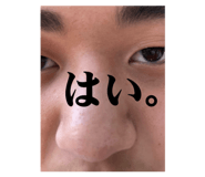 857523952