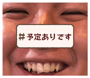 857846631
