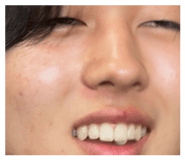 860651184