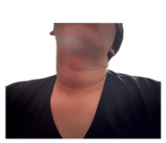 860804992
