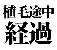 861041555