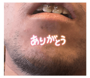 863530276