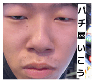 864088847