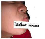 865012794