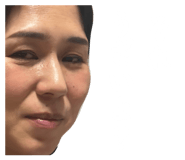 877518868