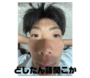 879316770