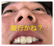 882264663