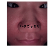 883532382