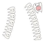 156