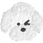 017