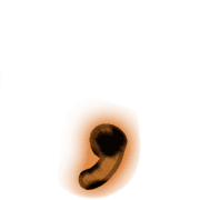 245