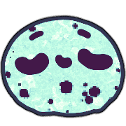 018