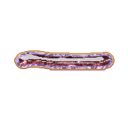 161