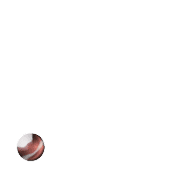 246