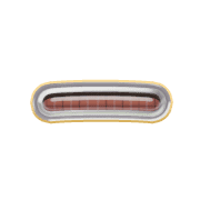 161