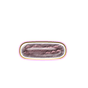 161