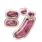 142