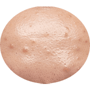 021
