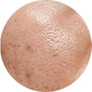 023