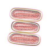 112
