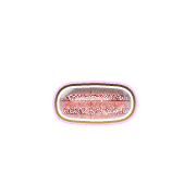 251