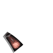 095