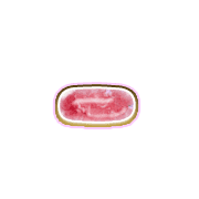 251
